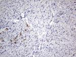 IGSF11 Antibody in Immunohistochemistry (Paraffin) (IHC (P))