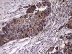 ACE2 Antibody in Immunohistochemistry (Paraffin) (IHC (P))