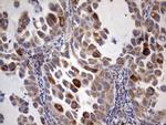 ACE2 Antibody in Immunohistochemistry (Paraffin) (IHC (P))