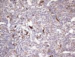 TRIM27 Antibody in Immunohistochemistry (Paraffin) (IHC (P))