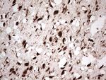 GLI1 Antibody in Immunohistochemistry (Paraffin) (IHC (P))