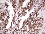 GLI1 Antibody in Immunohistochemistry (Paraffin) (IHC (P))