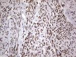 RTRAF Antibody in Immunohistochemistry (Paraffin) (IHC (P))