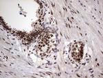 RTRAF Antibody in Immunohistochemistry (Paraffin) (IHC (P))