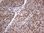 RTRAF Antibody in Immunohistochemistry (Paraffin) (IHC (P))