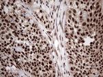 RTRAF Antibody in Immunohistochemistry (Paraffin) (IHC (P))