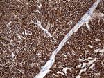 Enkurin Antibody in Immunohistochemistry (Paraffin) (IHC (P))