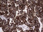 MIP-3 beta Antibody in Immunohistochemistry (Paraffin) (IHC (P))