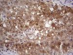 S100A6 Antibody in Immunohistochemistry (Paraffin) (IHC (P))