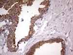 DDX6 Antibody in Immunohistochemistry (Paraffin) (IHC (P))