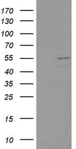 DDX6 Antibody in Western Blot (WB)