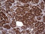 BFSP2 Antibody in Immunohistochemistry (Paraffin) (IHC (P))