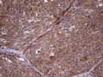 BFSP2 Antibody in Immunohistochemistry (Paraffin) (IHC (P))