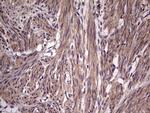 BFSP2 Antibody in Immunohistochemistry (Paraffin) (IHC (P))