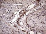 BFSP2 Antibody in Immunohistochemistry (Paraffin) (IHC (P))