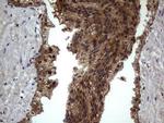 BFSP2 Antibody in Immunohistochemistry (Paraffin) (IHC (P))