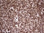 BFSP2 Antibody in Immunohistochemistry (Paraffin) (IHC (P))