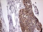 BFSP2 Antibody in Immunohistochemistry (Paraffin) (IHC (P))