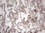 BFSP2 Antibody in Immunohistochemistry (Paraffin) (IHC (P))