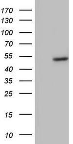 BFSP2 Antibody in Western Blot (WB)