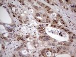 NAE1 Antibody in Immunohistochemistry (Paraffin) (IHC (P))