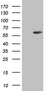 IKZF3 Antibody in Western Blot (WB)