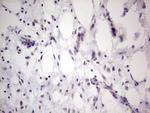 TCF12 Antibody in Immunohistochemistry (Paraffin) (IHC (P))