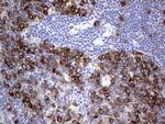 RRM1 Antibody in Immunohistochemistry (Paraffin) (IHC (P))