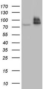 RRM1 Antibody in Western Blot (WB)