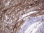 Periostin Antibody in Immunohistochemistry (Paraffin) (IHC (P))