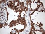 POMK Antibody in Immunohistochemistry (Paraffin) (IHC (P))