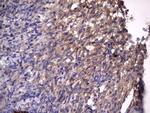 RSPO3 Antibody in Immunohistochemistry (Paraffin) (IHC (P))