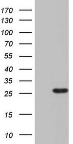 RSPO1 Antibody in Western Blot (WB)