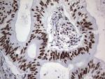 PPP1R8 Antibody in Immunohistochemistry (Paraffin) (IHC (P))