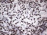 PPP1R8 Antibody in Immunohistochemistry (Paraffin) (IHC (P))