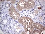 MAD2L1BP Antibody in Immunohistochemistry (Paraffin) (IHC (P))