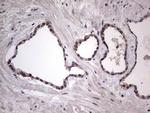 RAD23B Antibody in Immunohistochemistry (Paraffin) (IHC (P))