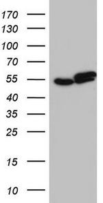 RAD23B Antibody in Western Blot (WB)