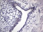 RAD23B Antibody in Immunohistochemistry (Paraffin) (IHC (P))