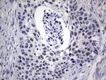 RAD23B Antibody in Immunohistochemistry (Paraffin) (IHC (P))