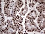 RAD23B Antibody in Immunohistochemistry (Paraffin) (IHC (P))