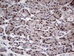 RAD23B Antibody in Immunohistochemistry (Paraffin) (IHC (P))