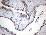 RAD23B Antibody in Immunohistochemistry (Paraffin) (IHC (P))