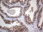 RAD23B Antibody in Immunohistochemistry (Paraffin) (IHC (P))