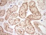 NOR-1 Antibody in Immunohistochemistry (Paraffin) (IHC (P))