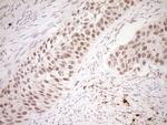 NOR-1 Antibody in Immunohistochemistry (Paraffin) (IHC (P))