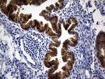 ASL Antibody in Immunohistochemistry (Paraffin) (IHC (P))