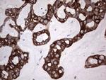 HIP55 Antibody in Immunohistochemistry (Paraffin) (IHC (P))