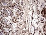 SAE1 Antibody in Immunohistochemistry (Paraffin) (IHC (P))