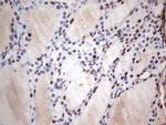 SAE1 Antibody in Immunohistochemistry (Paraffin) (IHC (P))